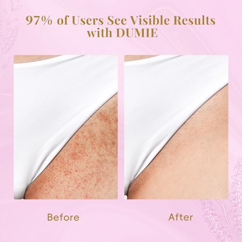 Cyperus Rotundus Roll-On Serum for Ingrown Hair & Razor Bumps