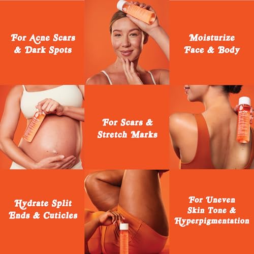 Bio-Oil Skincare Body Oil - Scars & Stretch Marks, 2 fl oz