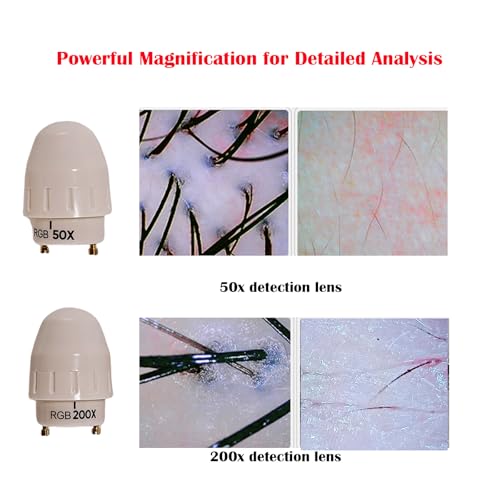 Professional Scalp Analysis Camera with 11-Inch HD Screen for Salons – NETTITO