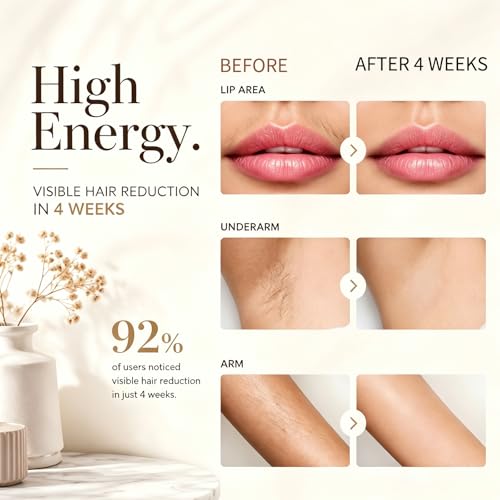 IPL Laser Hair Removal Device for Home Use, 999,999 Flashes, Permanent Hair Removal for Face, Legs, Arms, Bikini
