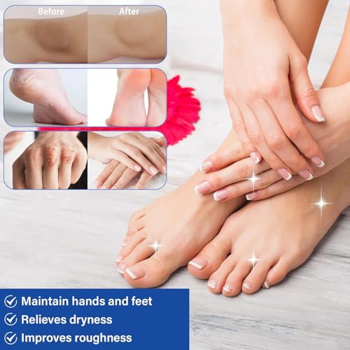 60% Urea Foot Cream with Salicylic Acid for Cracked Heels