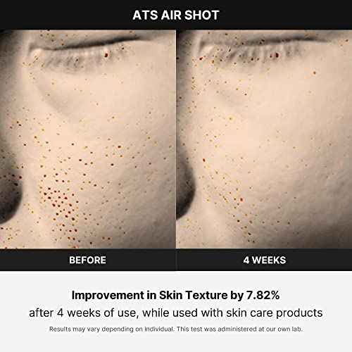 Medicube Age-R ATS Air Shot - Microneedling Pore Tightening Skin Care Device for Enhanced Absorption, Pore Refinement, and Smoother Skin Texture - Exfoliation, Skin Rejuvenation - Korean Skin Care