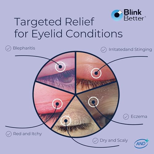 BetterLids Eyelid Ointment for Dry, Itchy & Sensitive Eyelids ? Deep-Moisturising Oat Complex with Shea Butter & Panthenol to Hydrate, Nourish & Soothe Delicate Eyelid Skin ? 0.34 oz