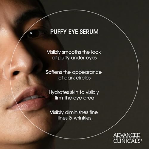 Advanced Clinicals Puffy Eye Serum | Caffeine & Hyaluronic Acid, 1.75 Fl Oz