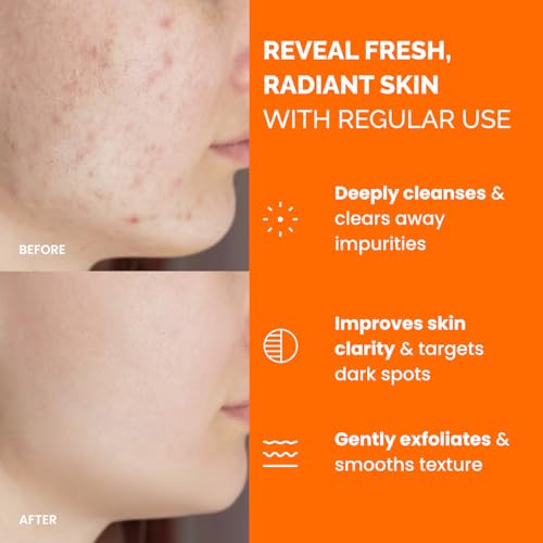 Kojic Acid & Turmeric Cleansing Pads - Dark Spots & Hyperpigmentation, 60 Pcs