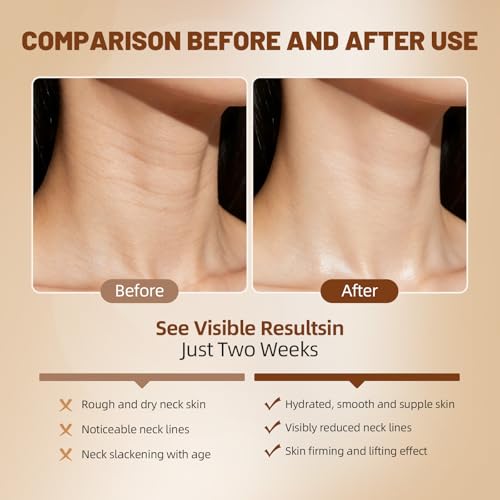 Korean Neck Cream, 3.53 oz Hydrating & Firming Neck Moisturizer for Smoother, Softer, More Supple Skin ? Nourishing Daily Neck Care for Dry, Aging & Sensitive Skin