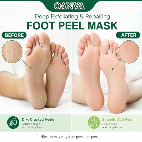 OANVA Exfoliating Foot Peel Mask (3 Pack) - Callus Remover for Cracked Heels