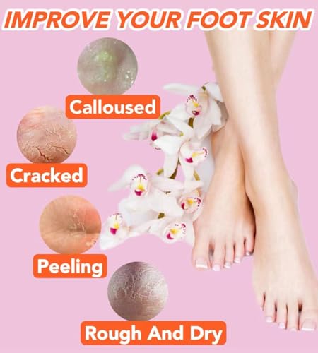 Pink & Beige Silicone Moisturizing Socks for Women - 2 Pairs Fits Up to Size 10, Cracked Heel Repair & Softening Skin
