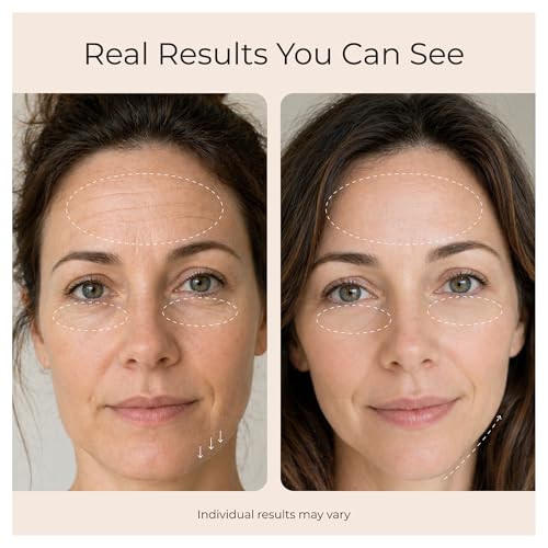 Lifting Mask System with 5 Conductive Facial Masks by NARASKIN LAB