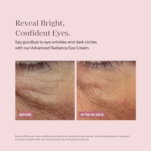 Pretti5 Advanced Radiance Eye Cream Tackles Puffiness, Dark Circles, Boosts Circulation & Smooths Fine Lines Around the Eyes Japanese Skincare Vegan Sensitive Skin Safe 12g