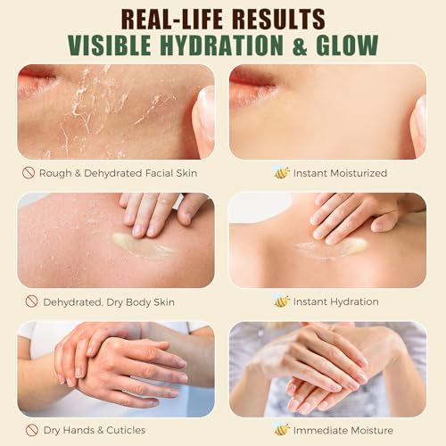 Tallow and Honey Balm for Face,Beef Tallow for Skin Face,Grass-Fed Whipped Beef Tallow & Raw Wild Honey Blend, Natural Formula,Deep Hydration, Soothes Dryness, Repairs Skin Barrier