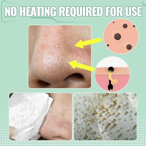 SYABO 2.0 Blackhead Remover Mask with Salicylic Acid | 100 Strips