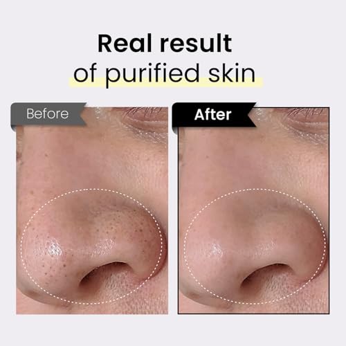 Coxir TXA Black Rice Pore Mask ? Korean 3-in-1 Wash-Off Mask Serum| Pore Purifying, Blackhead Care, Hydrating, Skin Toning Treatment with TXA & Black Rice |Vegan K-beuaty Face Mask [50ml/1.69 fl.oz]