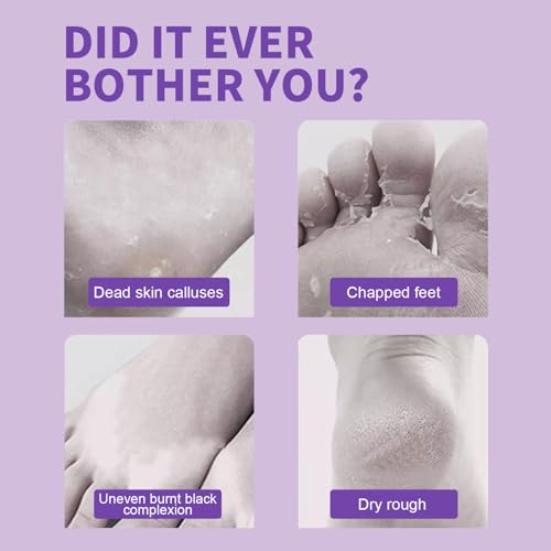 Foot Peeling Mask - 5 Pack Exfoliating Socks for Dry Cracked Feet