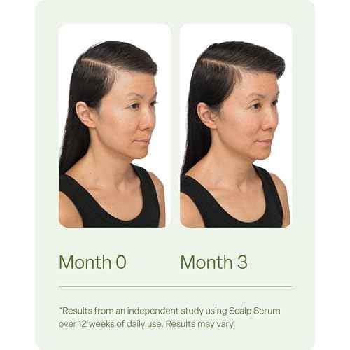 Divi Healthy Hair Bundle: Scalp Serum 1 fl oz and Hair Vitamins, 30-Day Supply