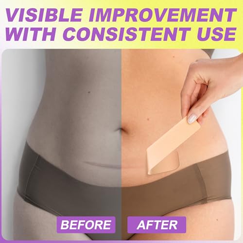 FRESINIDER Silicone Scar Sheets Roll - 1.6" X 120" (3 Meters) Silicone Scar Tape for Surgical C-Section Tummy Tuck, Keloid Burn Acne - Extra Long & Reusable Professional Scar Removal Strips