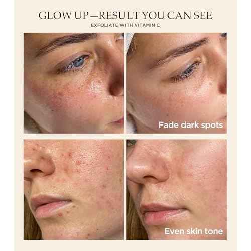 Vitamin C and Turmeric Face Scrub, Face Scrub for All Skin Types -Physical Scrub to Exfoliate Face & Body, Anti Aging Facial Exfoliating Scrub, Clears Blackheads Improve Dark Spots 4.23 Oz