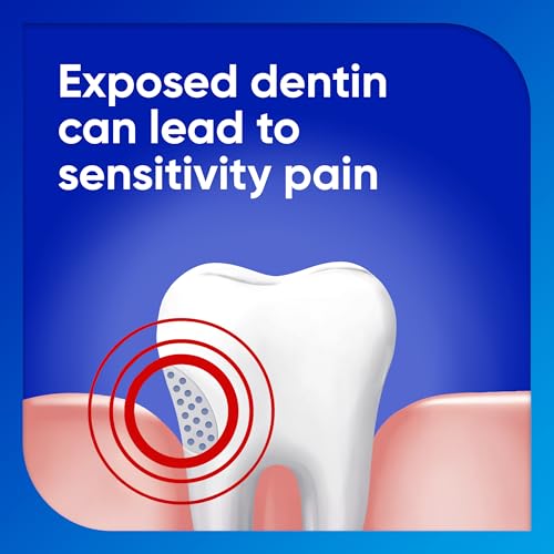 Sensodyne Extra Whitening Sensitive Toothpaste, Cool Mint (4 oz, Pack of 4)