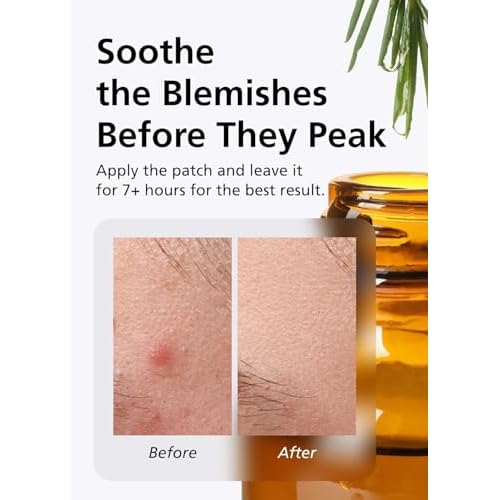EasyDerm Relief Invisible Patch 4 Packs (168 Patches) | 10,000 ppm Tea Tree Oil, Ultra-Slim 0.1mm, Waterproof Acne Patch, Clear Skin Essential for Spring & Daily Care
