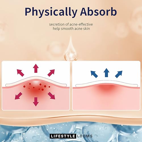 Hydrocolloid Acne Patch with Free Saline Wipe ? Invisible Skin Care Stickers for Face & Acne ? Fast Healing Pimple Patches, Stocking Stuffers for Teen Girls, (RED 72 PATCHES)