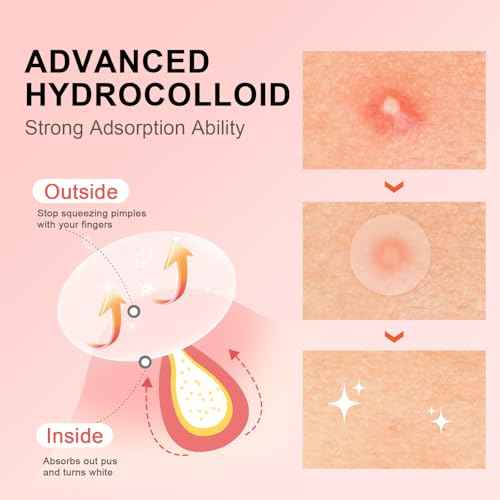 AVJONE Pimple Patches for Face(144 Patches), Hydrocolloid Acne Patches with Tea Tree Oil, pimple stickers for Breakouts, Absorbs Zit, Invisible Spot Cover and Blemish