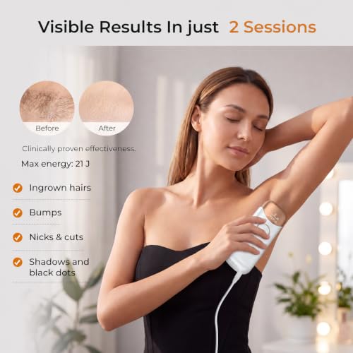 Ubroo Laser Hair Removal Device White - Hair Reduction in 2 Sessions