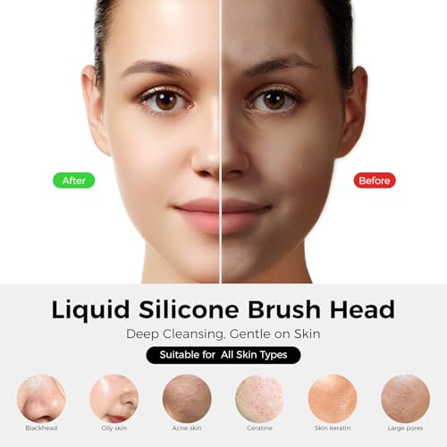 Electric Facial Cleansing Brush with 4 LED Light & 5 Vibration Levels