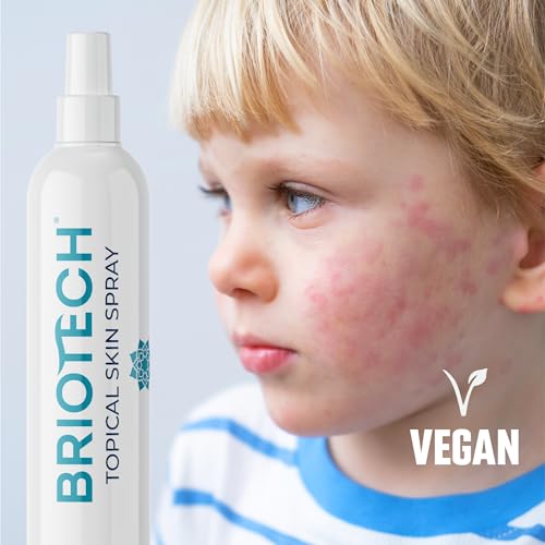 BRIOTECH Hypochlorous Acid Spray, Topical Skin Face & Body Mist, Support Irritations, Soothe Redness, Dry Skin & Scalp, Athletic Itch, Packaging May Vary