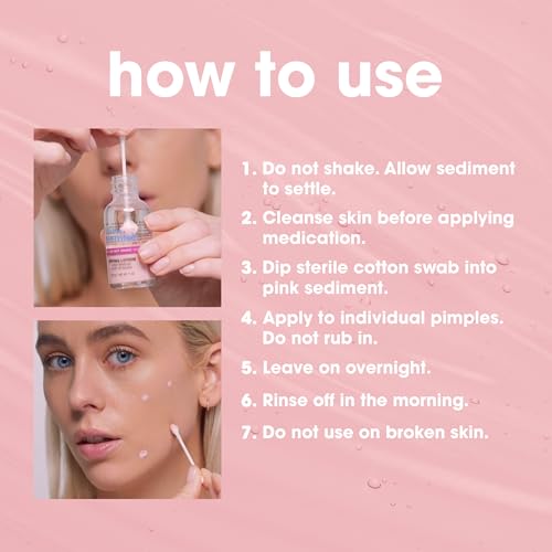 Bye Bye Blemish Acne Drying Lotion, Reduce Pimples Overnight 1oz, 1-Pack