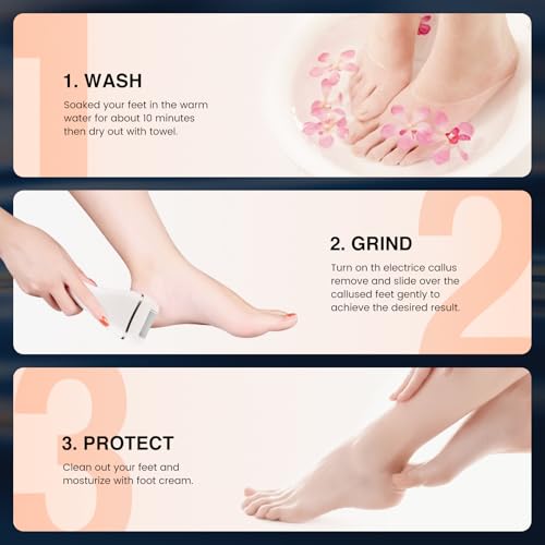Electric Foot Callus Remover - Rechargeable Pedicure Tool