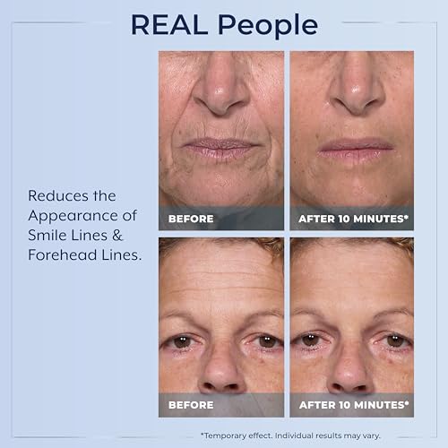 Plexaderm Rapid Reduction Eye Serum - 30 Single-Use Pods for Under-Eye Bags