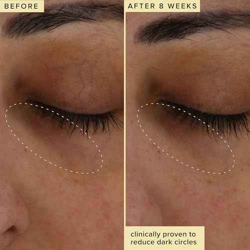 Farmacy Wake Up Honey Vitamin C Eye Cream - Brightening Under Eye Cream for Dark Circles + Puffiness - Enriched with Cranberry Peptide to Smooth Wrinkles Over Time (15ml)