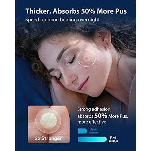 LitBear Acne Pimple Patches- Day and Night 4 Sizes 360 Dots Thin & Thick Hydrocolloid Patches with Witch Hazel, Tea Tree & Calendula Oil, Extra Adhesion Pimple Patches for Face Zit Patch Acne Dots