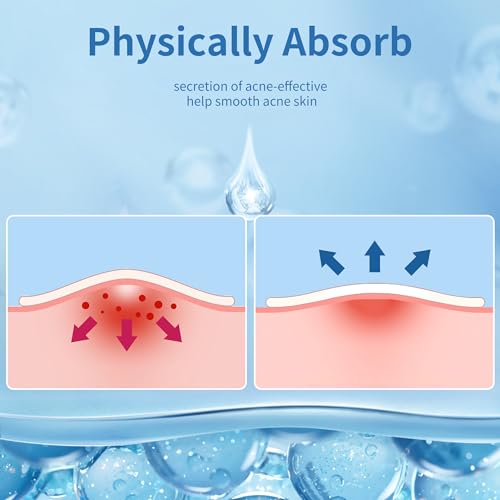 Daolyo Acne Patches 300 Count - Hydrocolloid Pimple Stickers