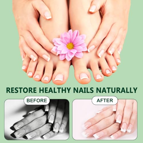 Tea Tree & Ginger Nail Treatment Serum for Weak Brittle Nails - 2 Pack