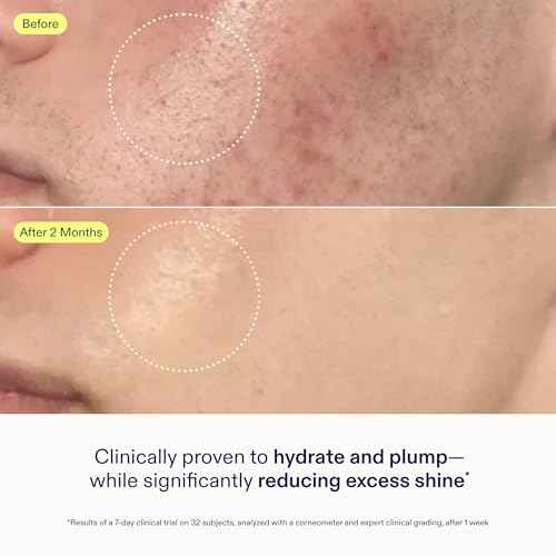 Skinfix Skin Barrier Restoring Gel Cream - 1.7 oz Refill - Non-Greasy Moisturizer for Normal to Combination Skin - Hydrates, Plumps & Smooths - Non-Comedogenic, Fragrance Free, Vegan, Cruelty Free