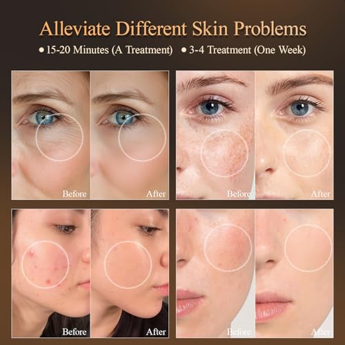 MEGELIN 7-Color LED Light Therapy Facial Mask
