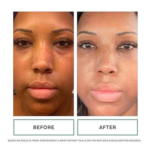 Replenix Redness Reducing Triple AOX Cream, Hydrating Medical-Grade Antioxidant Facial Treatment with Soothing Green Tea for Sensitive Skin (1 fl. oz)