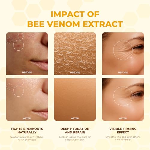 Bee Venom Cream | Hydrating, Smoothing, Firming, Wrinkle-Reducing | Comprehensive Bee Venom Skin Treatment Cream (Enhanced Formula)