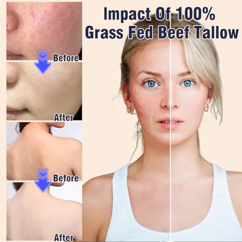 Beef Tallow Face Moisturiser - 100% Grass Fed Beef Tallow for Skin Care - Natural Handmade Lotion Whipped Beef Tallow Cream for Face & Body Sensitive Skin (New Black)