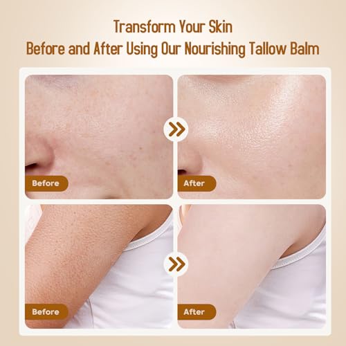 Grass-Fed Beef Tallow & Honey Balm - Face & Body Moisturizer 4oz