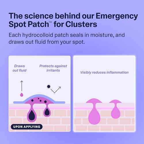 Curology Emergency Spot Patch Clusters for Breakouts, Stocking Stuffer Gifts, Fast Acting Large Hydrocolloid Pimple Patches for Face, Oil Absorbing, 14 Count
