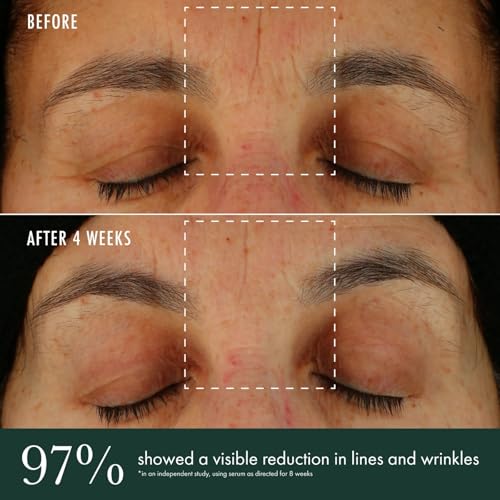 ReVive Brightening Vitamin C Serum for Radiant Skin, Reduces Wrinkles & Dark Spots