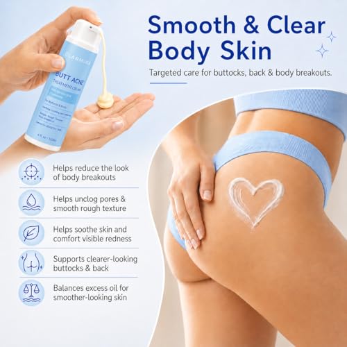 Body Acne Cream with 2% Salicylic Acid, Tea Tree Oil & Chamomile