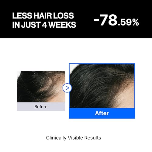 Balancing Hair Growth Serum for Sensitive Scalp - Non-Greasy Care