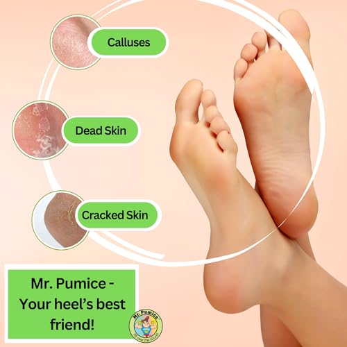 Mr. Pumice Callus Remover Pumi Bar - Foot Scrubber & Pedicure Stone (4-Pack)
