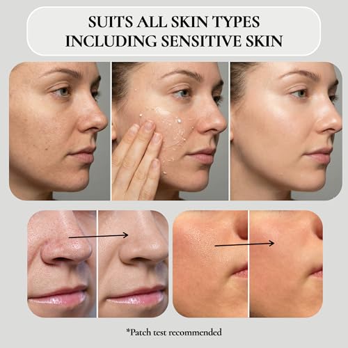 Vivo Per Lei Facial Peeling Gel - Helps Address Dead Skin Buildup - Gentle Exfoliating Gel for Rough, Dry, Sensitive or Mature Skin - Face and Body Scrub - Non Abrasive - 4.05 Fl. Oz. - Pack of 2