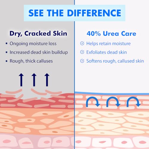 Ebanel Urea Cream 40% with Salicylic Acid for Dry Cracked Feet Skin Care