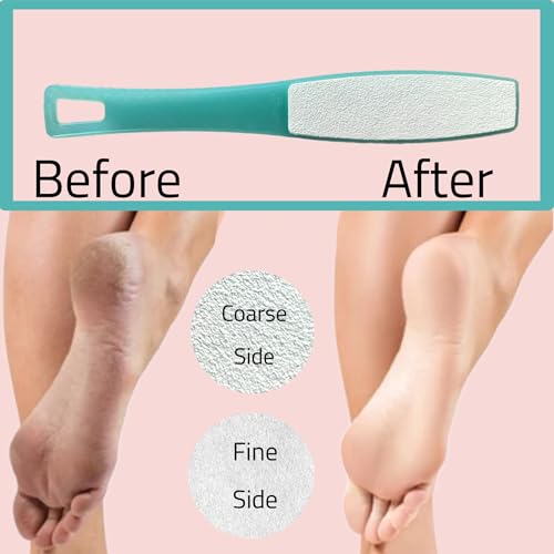 Blue Double Sided Foot File Pumice Scrubber for Callus & Heel Exfoliation - Ergonomic Handle