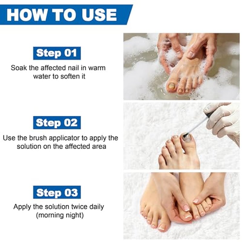 AOUGK Toenail Fungus Treatment - Extra Strength 25% Undecylenic Acid, 30ML
